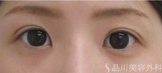 症例NO.28959のAFTER写真