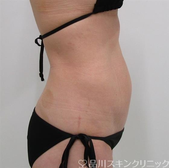症例NO.36118のBEFORE写真