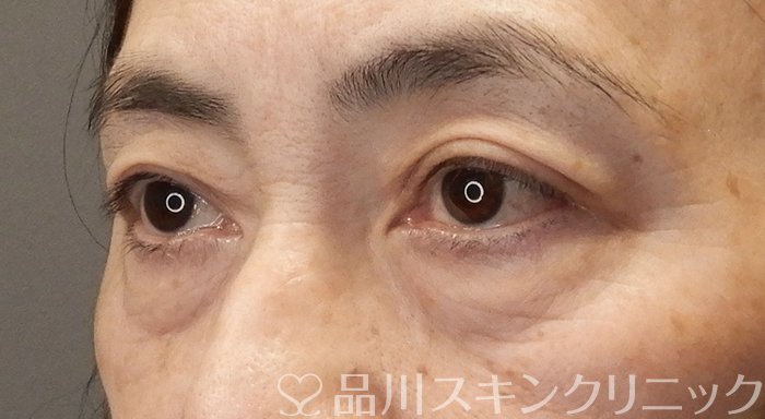 症例NO.70629のBEFORE写真