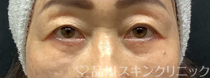 症例NO.69668のAFTER写真
