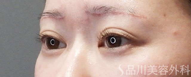 症例NO.73107のAFTER写真