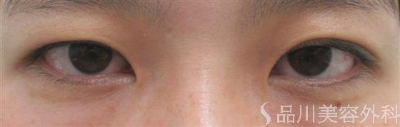 症例NO.21097のBEFORE写真