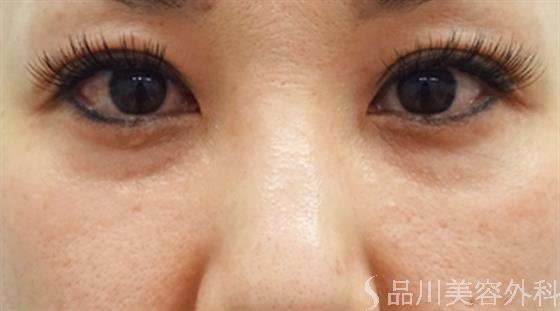 症例NO.40665のBEFORE写真