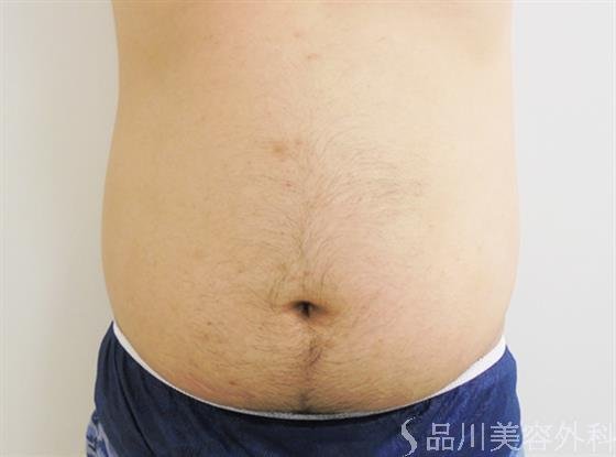 症例NO.24274のBEFORE写真