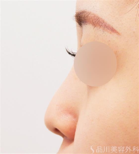 症例NO.52086のBEFORE写真