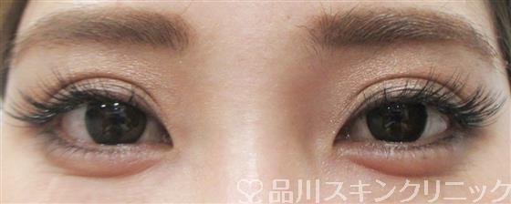 症例NO.27432のAFTER写真