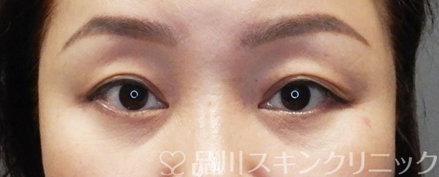 症例NO.73276のBEFORE写真