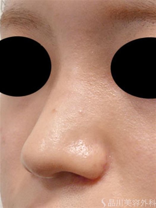 症例NO.54273のAFTER写真