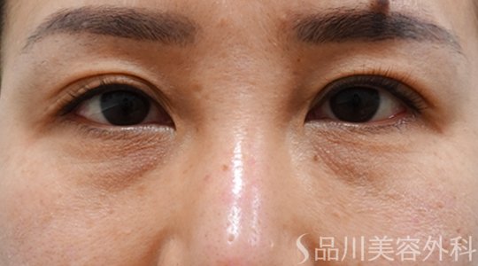 症例NO.70207のBEFORE写真