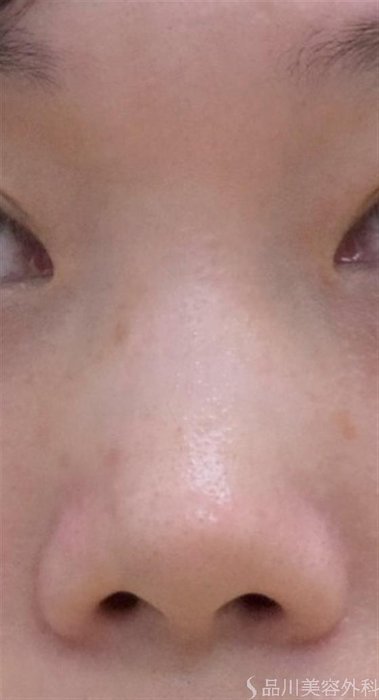 症例NO.58236のBEFORE写真