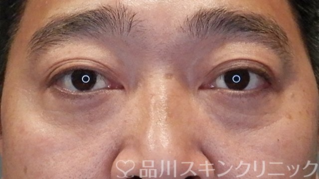 症例NO.65294のAFTER写真