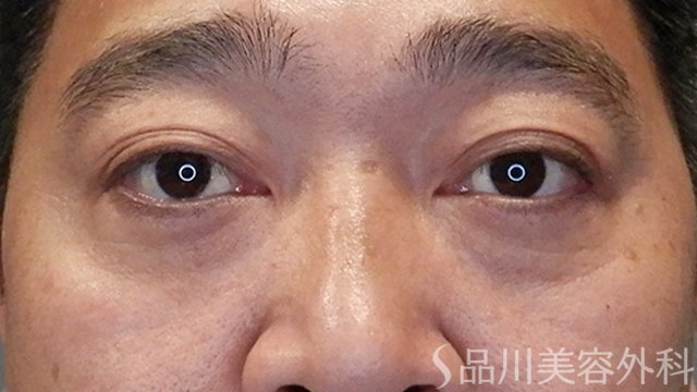 症例NO.65294のAFTER写真