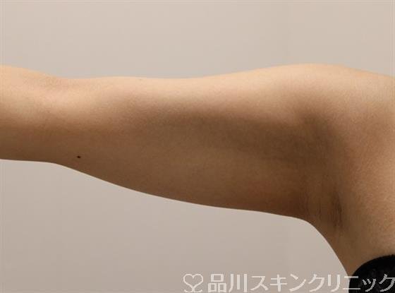 症例NO.48001のBEFORE写真