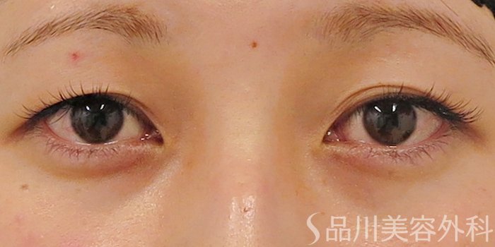 症例NO.70012のBEFORE写真