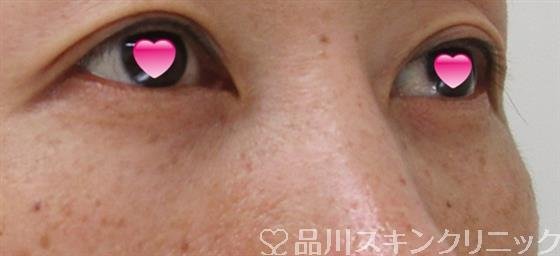 症例NO.42508のAFTER写真