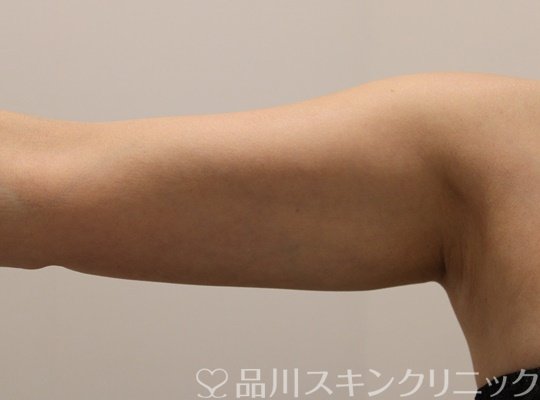 症例NO.65572のAFTER写真