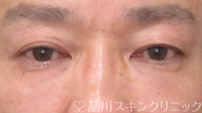 症例NO.69714のAFTER写真