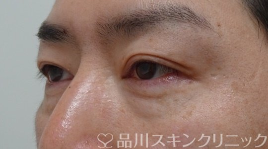 症例NO.70784のBEFORE写真