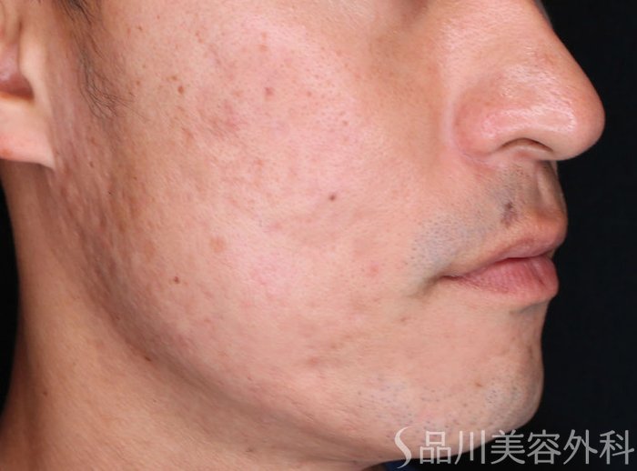 症例NO.73002のAFTER写真