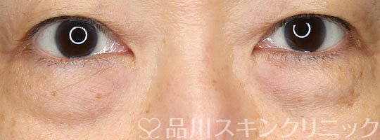 症例NO.67639のBEFORE写真