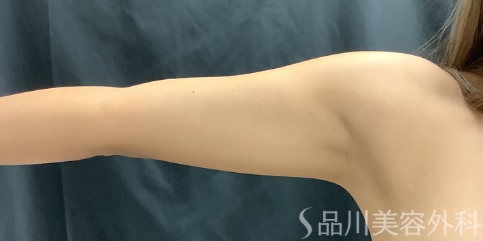 症例NO.68478のBEFORE写真