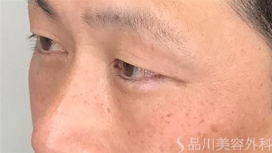 症例NO.59260のBEFORE写真