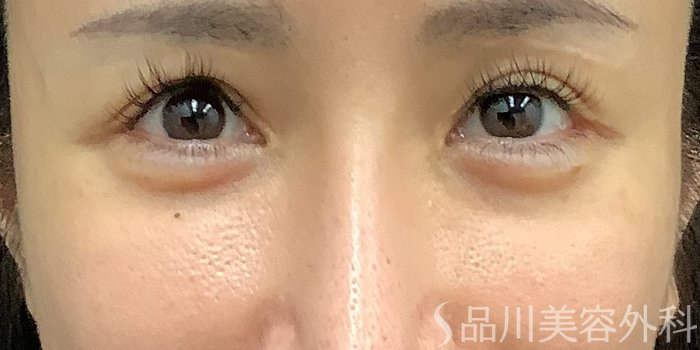 症例NO.67804のBEFORE写真