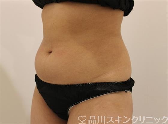 症例NO.47298のBEFORE写真
