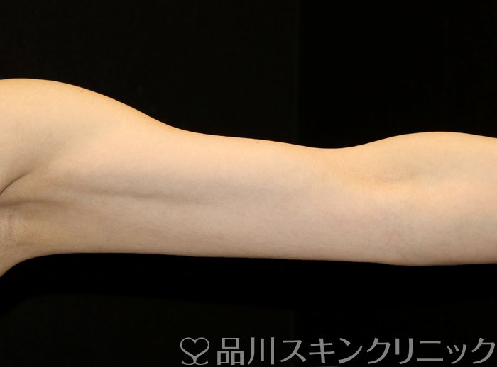 症例NO.71389のAFTER写真
