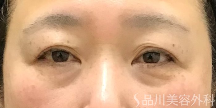 症例NO.70157のBEFORE写真