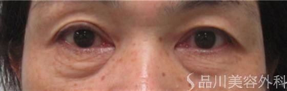 症例NO.12202のBEFORE写真