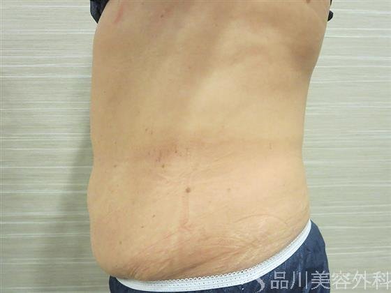 症例NO.20563のBEFORE写真