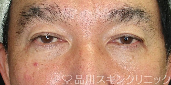 症例NO.73787のAFTER写真