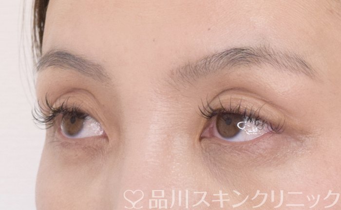 症例NO.70234のBEFORE写真