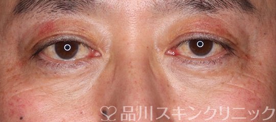 症例NO.70877のAFTER写真