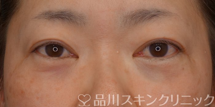 症例NO.73114のAFTER写真