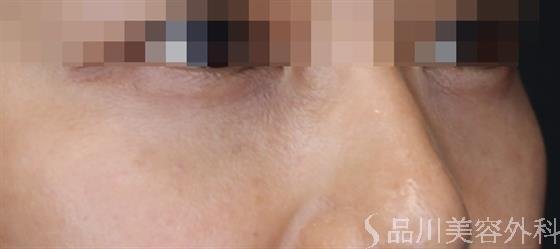 症例NO.58273のAFTER写真
