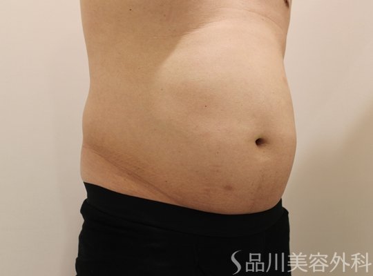 症例NO.70691のBEFORE写真