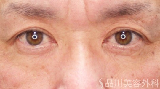 症例NO.69863のBEFORE写真