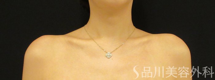 症例NO.71027のAFTER写真