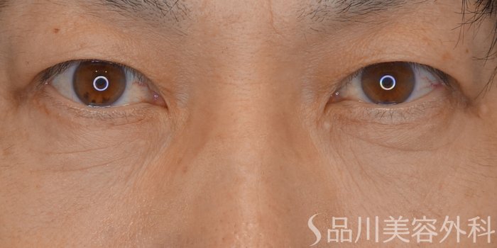 症例NO.71953のAFTER写真