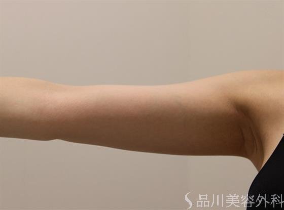 症例NO.48733のAFTER写真