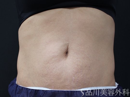 症例NO.75189のBEFORE写真