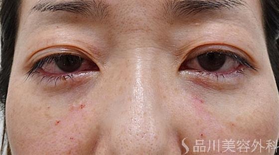 症例NO.54274のAFTER写真