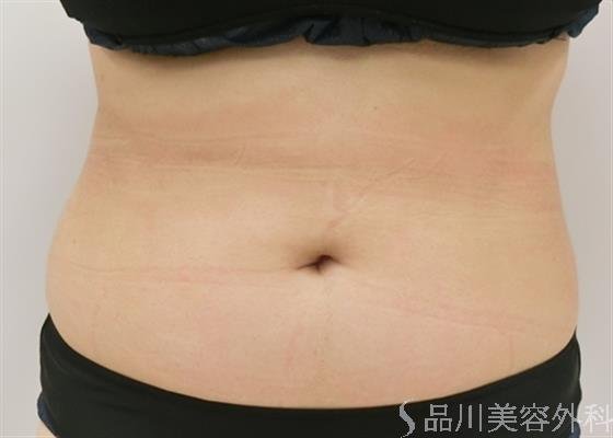 症例NO.27897のBEFORE写真