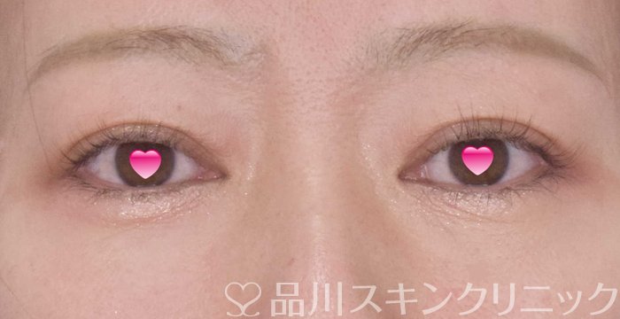 症例NO.65098のAFTER写真