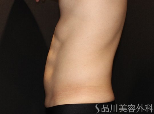 症例NO.73339のAFTER写真