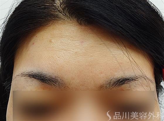 症例NO.36143のAFTER写真