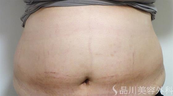 症例NO.38510のBEFORE写真