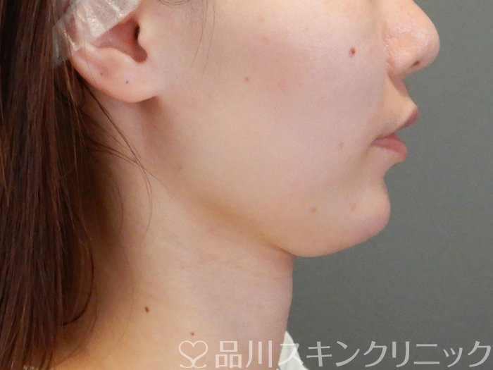 治療期間全体で予想される費用